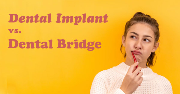 Dental Implant vs. Dental Bridge: Which One Should I Get?