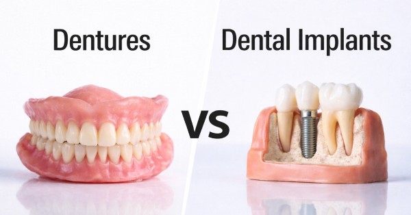 Side-by-side image labeled ‘Dentures vs Dental Implants.’ Left shows removable pink dentures with artificial teeth. Right shows a jaw model with a titanium dental implant near me in Grand Prairie screw and crown next to natural teeth.