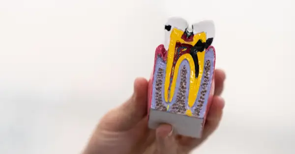 Helpful dental information about root canal in Grand Prairie