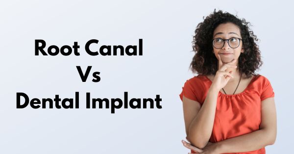 Root Canal vs Implant in Grand Prairie: What’s Best for You?