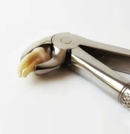 Emergency Tooth Extraction in Grand Prairie Emergency Tooth Extraction in Grand Prairie