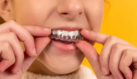 Affordable Invisalign Consultation and Treatment Affordable Invisalign Consultation and Treatment