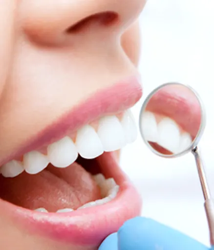 How Long Do Tooth-Colored Fillings Last? How Long Do Tooth-Colored Fillings Last?
